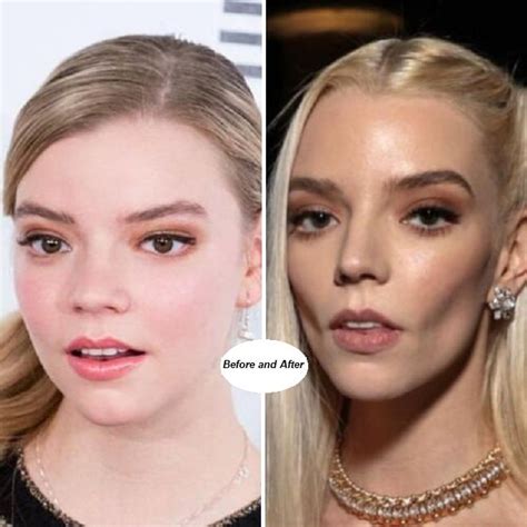 Anya Taylor Joy before surgeries : r/trueratecelebrities。